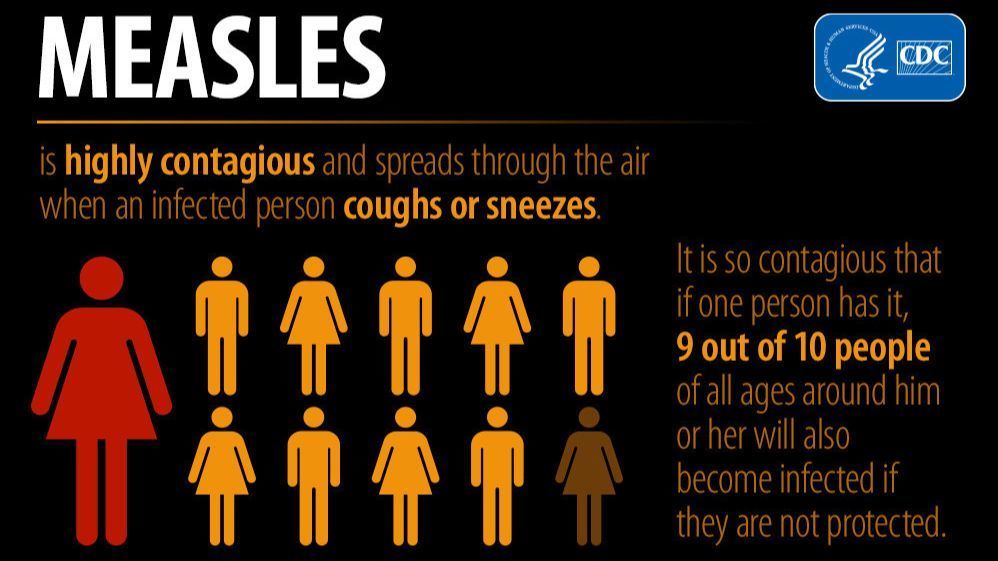 Maryland resident tests positive for measles, officials say