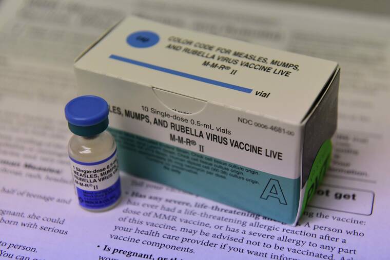 DOH confirms community-acquired mumps case on Hawaii island