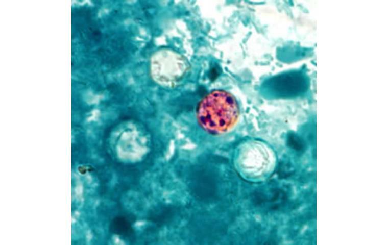 Michigan health officials ID ‘potential source’ of explosive diarrhea parasite